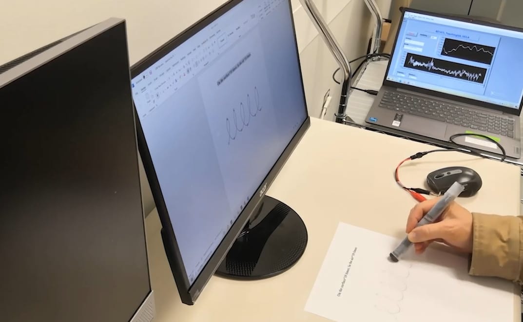 The AI-Powered Pen: A Stroke of Genius in Parkinson’s Detection
