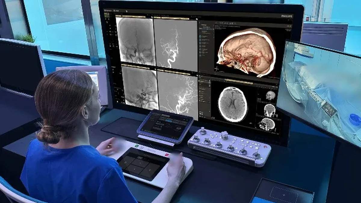 🤖 Stroke Care Wants Remote Hands