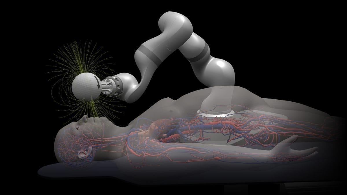 🤖 Stroke Robots Enter Blood Vessels
